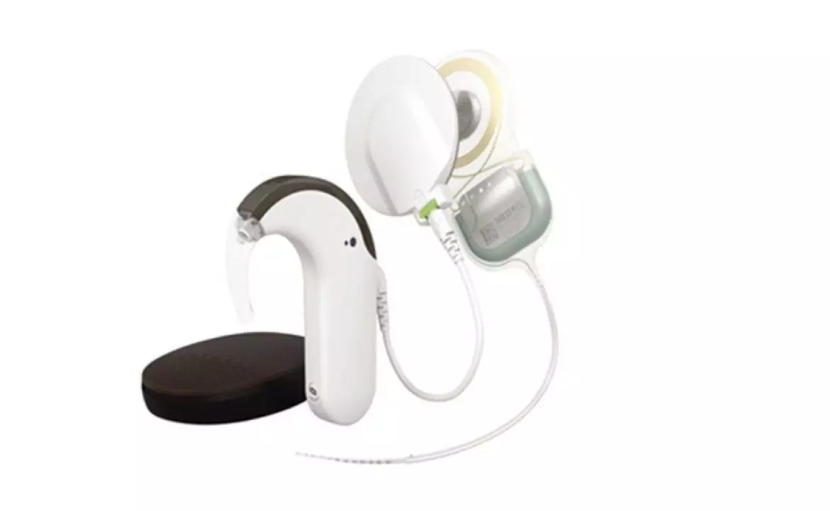 SYNCHRONY 2 Cochleáris Implantátum SYNCHRONY 2 Cochleáris Implantátum