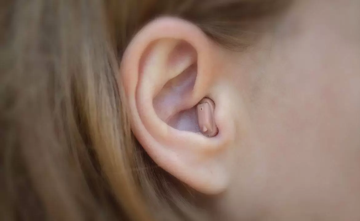 In-The-Ear Hearing Aids